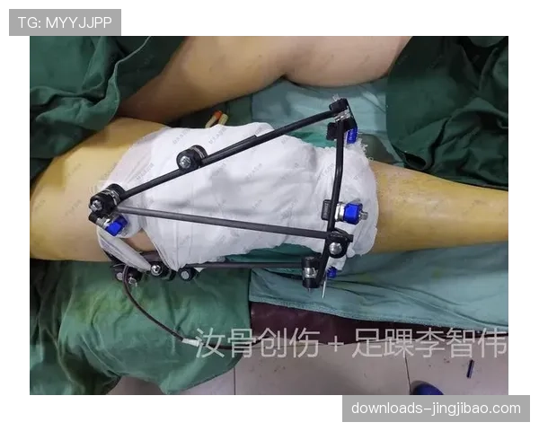 奇克戴橡胶护具复出，米兰中场谈下颌骨折恢复过程